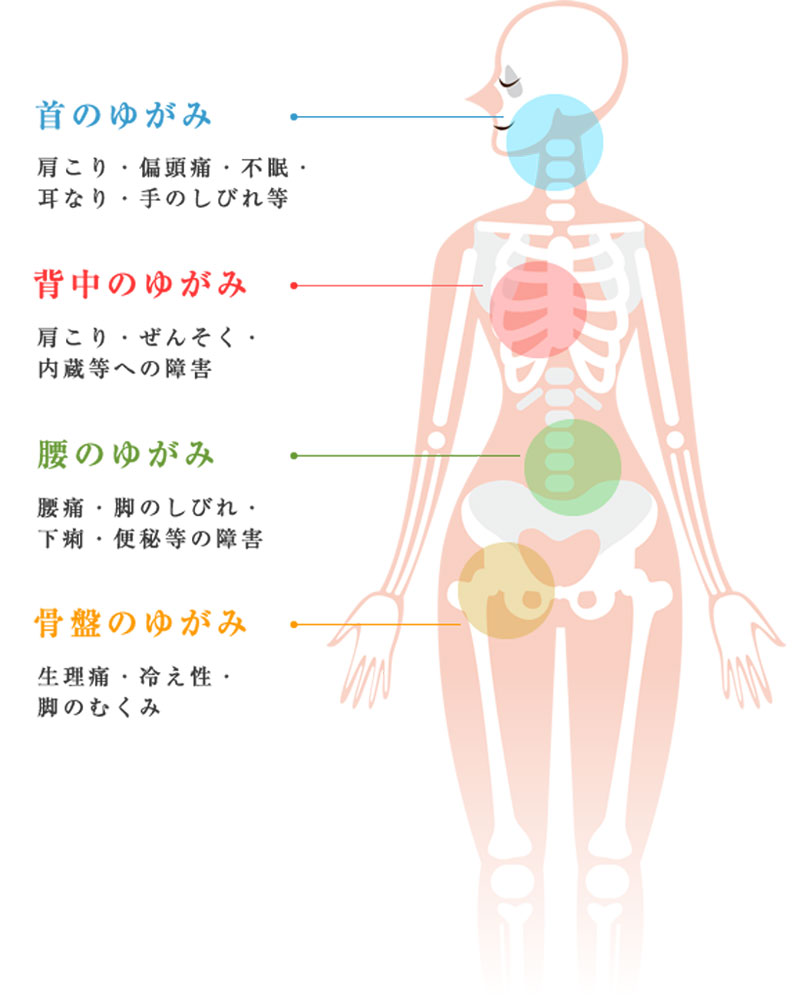 首のゆがみ：肩こり・偏頭痛・不眠・耳鳴り・手の痺れ等／背中のゆがみ：肩こり・ぜんそく・内臓等への障害／腰のゆがみ：腰痛・足のしびれ・下痢・便秘等の障害／骨盤のゆがみ：生理痛・冷え性・腰のむくみ