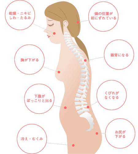 歪んだ骨格イメージ：乾燥・ニキビ・しわ・たるみ・胸が下がる・下腹がぽっこりと出る・冷え・むくみ・頭の位置が前にずれている・猫背になる・くびれがなくなる・お尻が下がる